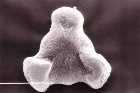 Fig. 4 Pollen (tricolpat) (photo: electron microscope) (Erlinghagen 1991)