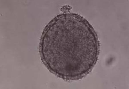 bluetenstaub von knautia arvensis dipsacaceae glyzerin gelatinepraeparat fache vergroeerung bluetenstaub von knautia arvensis dipsacaceae glyzerin gelatinepraeparat fache vergroeerung